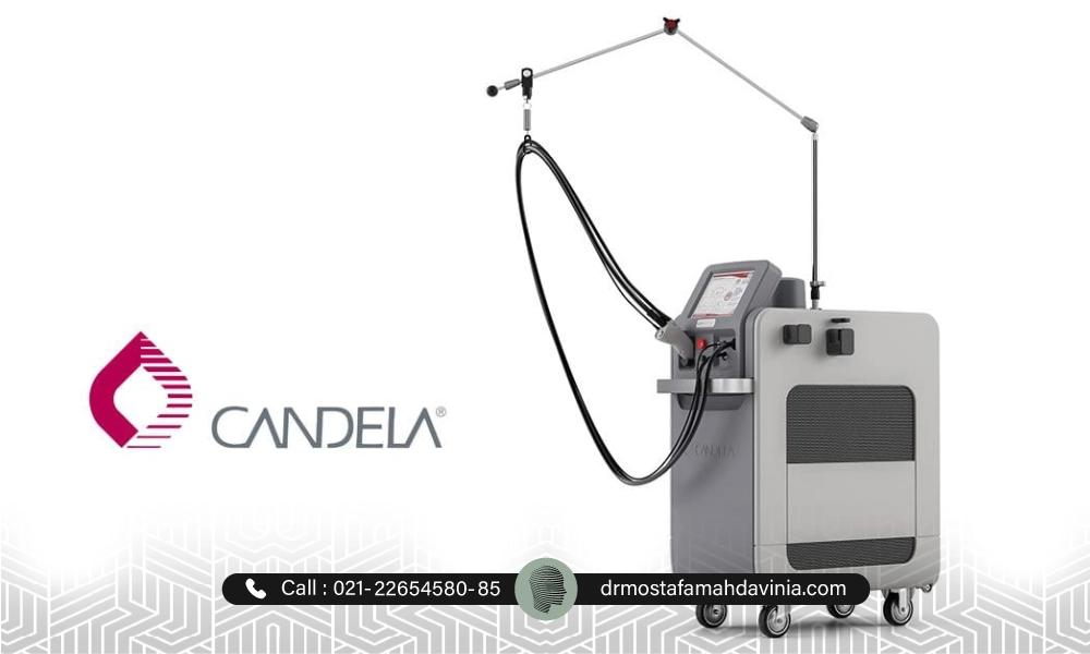 لیزر کندلا بهترین دستگاه لیزر موهای زائد