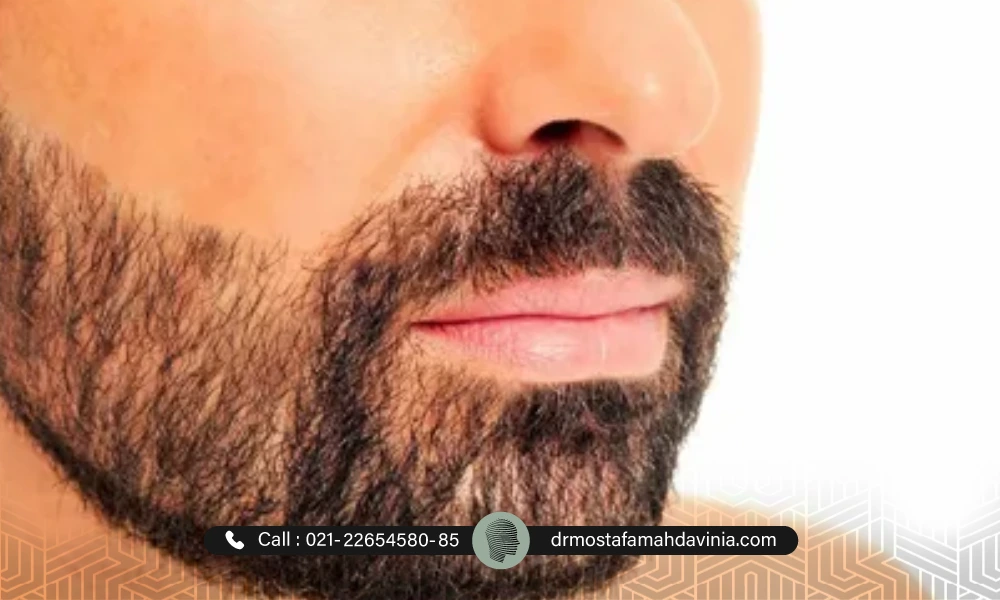 آقایی با صورت تمییز و آنکارد شده بعد از لیزر