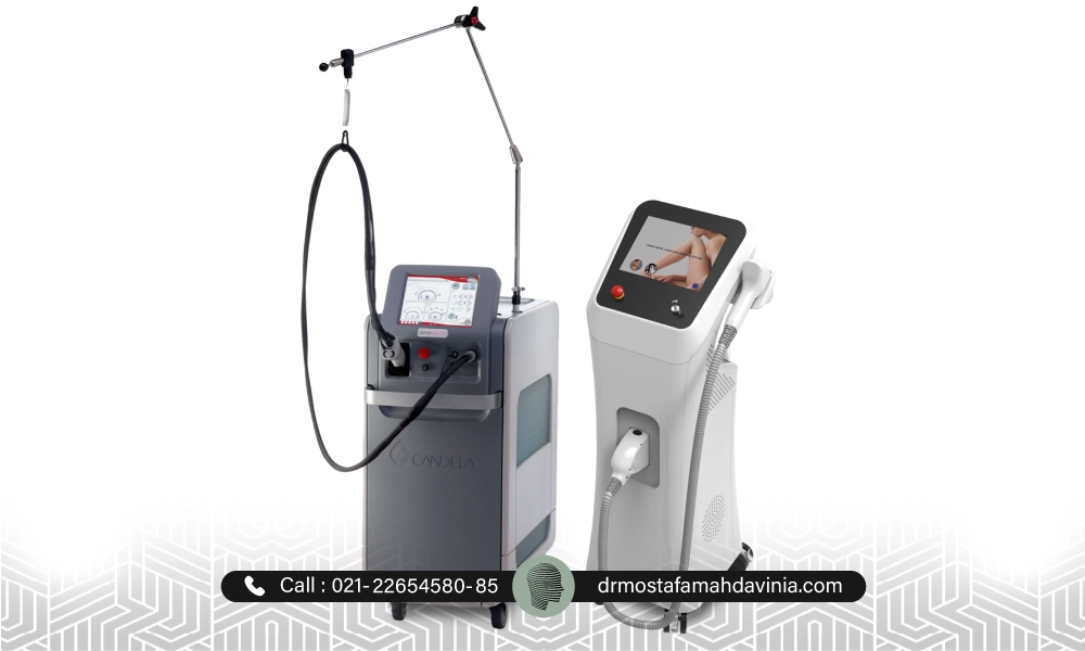 دستگاه های لیزر موهای زائد الکساندرایت کندلا | عوارض لیزر الکساندرایت کندلا