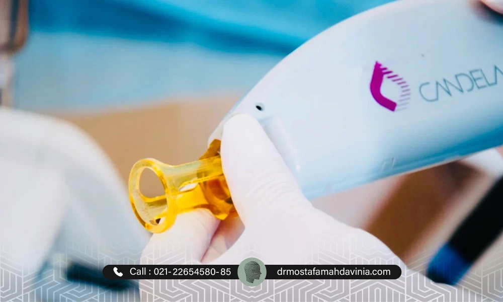 هندپیس دستگاه کندلا جنتل مکس پرو | عوارض لیزر الکساندرایت کندلا