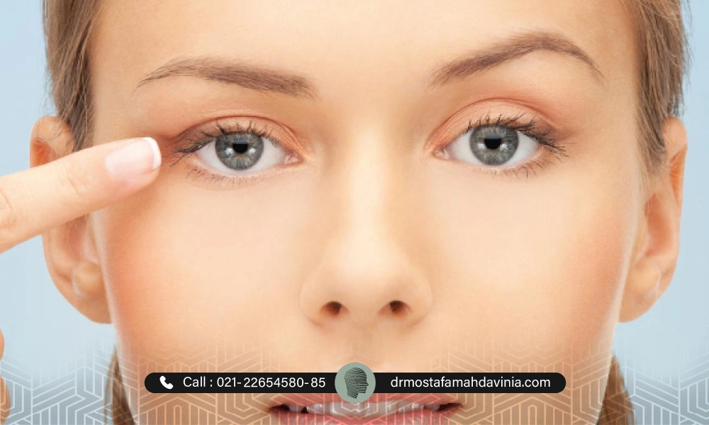 خانمی با چشمان سبز رنگ که به افتادگی پلک راست خود اشاره می کند.