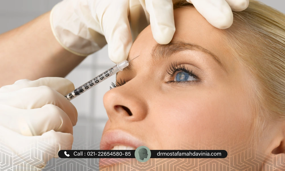 تزریق بوتاکس برای خط اخم