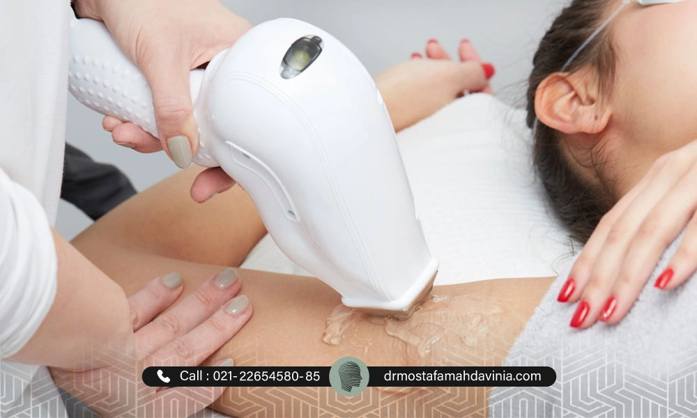 چندمین جلسه برای لیزر موهای زائد زیر بغل | تعداد جلسات لیزر موهای زائد
