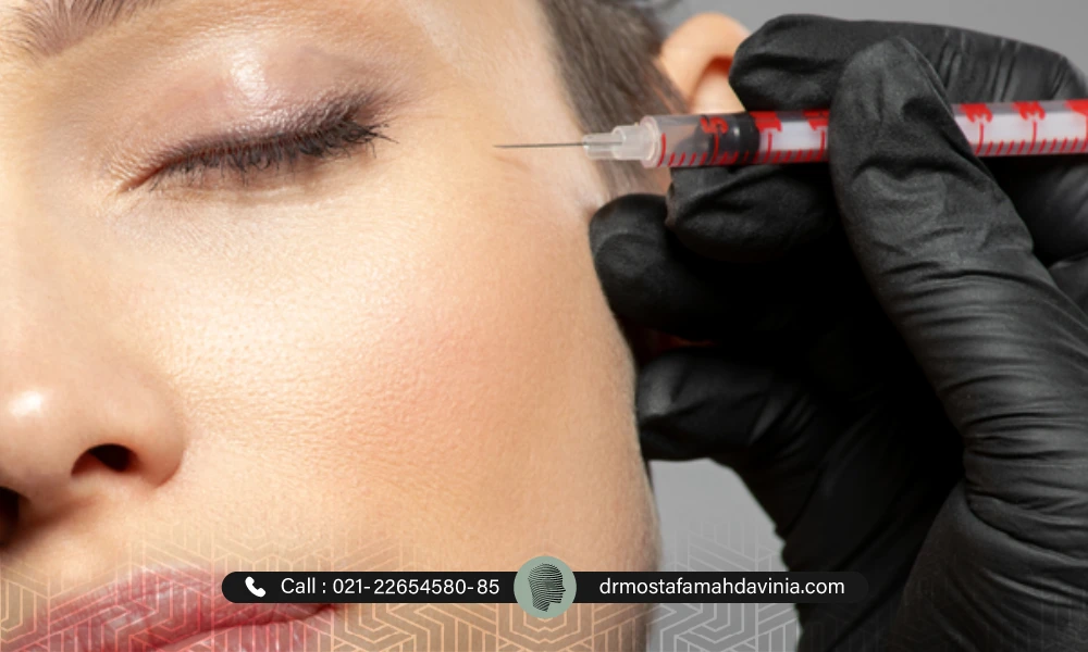 تزریق بوتاکس به اطراف چشم برای جوانسازی