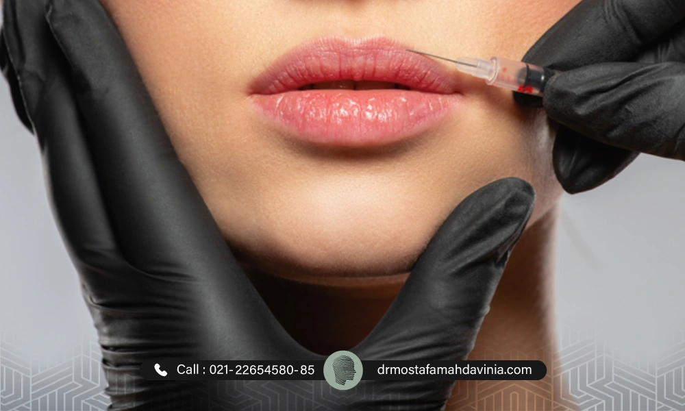 تزریق بوتاکس به لب های یک خانم توسط پزشک با دستکش سیاه