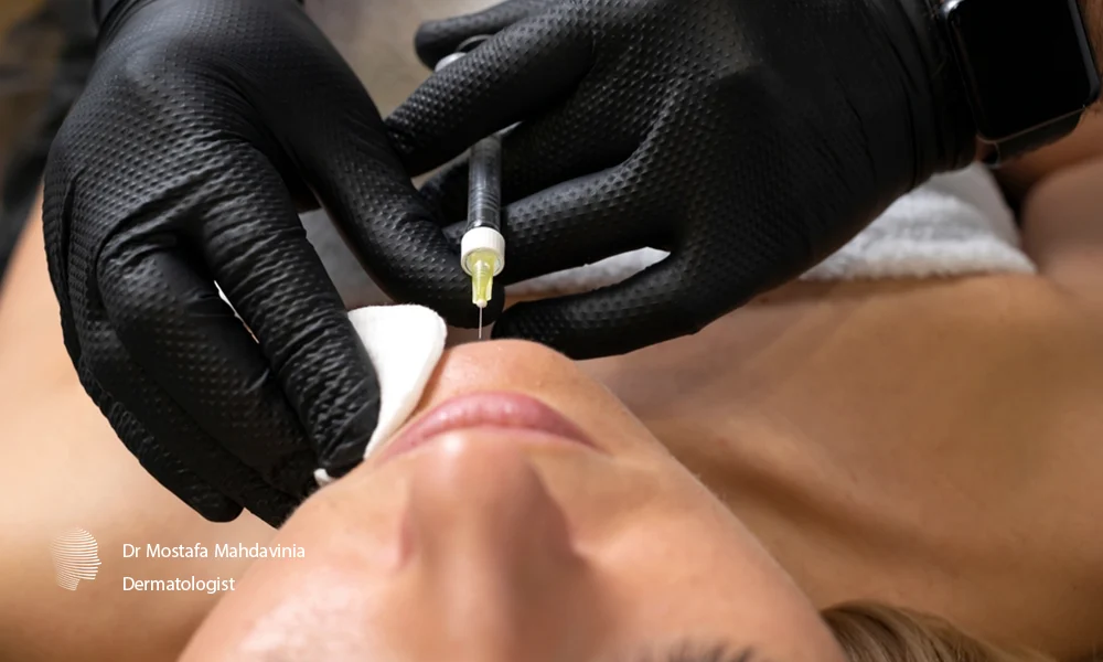 تزریق ژل چانه توسط پزشک متخصص زیبایی برای مراجعه کنندگان