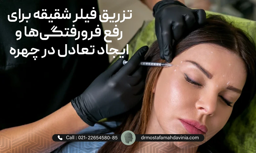 Temple filler injection for a woman • 1