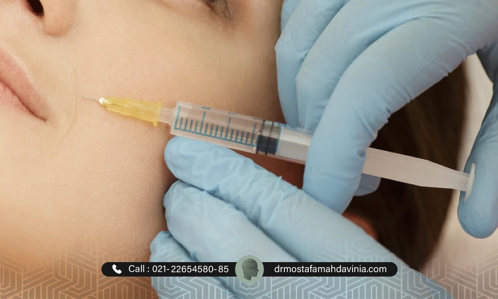 پزشک با دستکش های آبی در حال تزریق فیلر خط خنده می باشد.