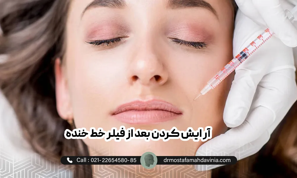 پزشک با دستکش های سفید در حال تزریق فیلر خط خنده به یک خانم که چشمان خود را بسته