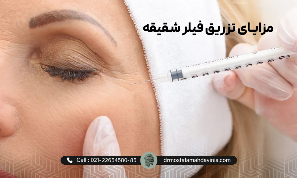 خانمی با چشمان بسته و دراز کشیده و پزشک در حال تزریق فیلر شقیقه به خانم