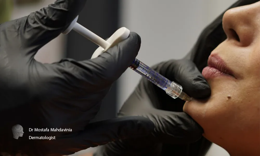 اصلاح فرم چانه یک زیباجو با فیلر برای تزریق فیلر چانه