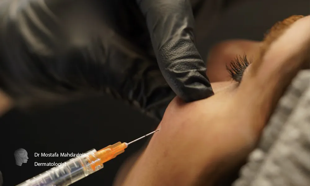 تزریق فیلر گونه در کلینیک دکتر مهدوی نیا