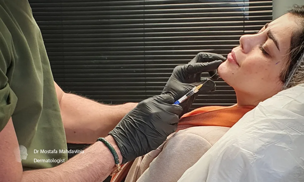 تزریق فیلر چانه در کلینیک دکتر مهدوی نیا