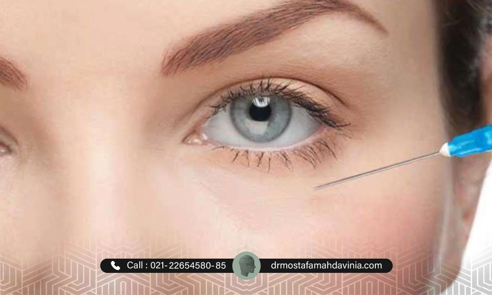 خانمی با چشم های رنگی در حال دریافت فیلر زیر چشم