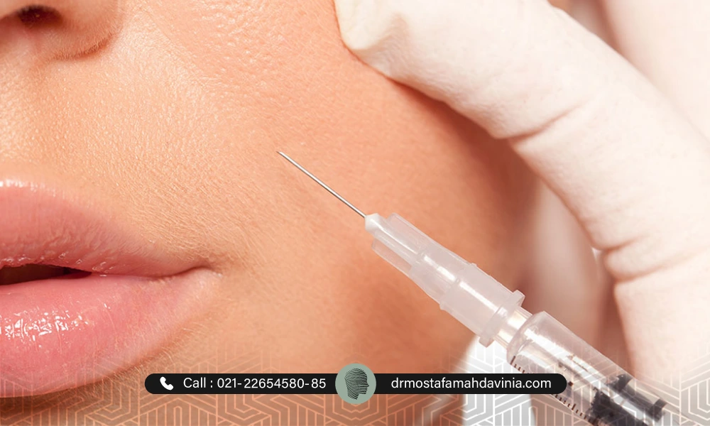 تزریق فیلر خط خنده به متقاضی خانم