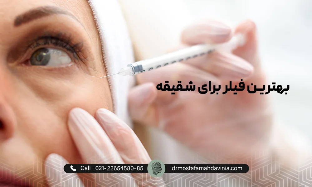 پزشک در حال تزریق بهترین فیلر شقیقه برای یک خانم