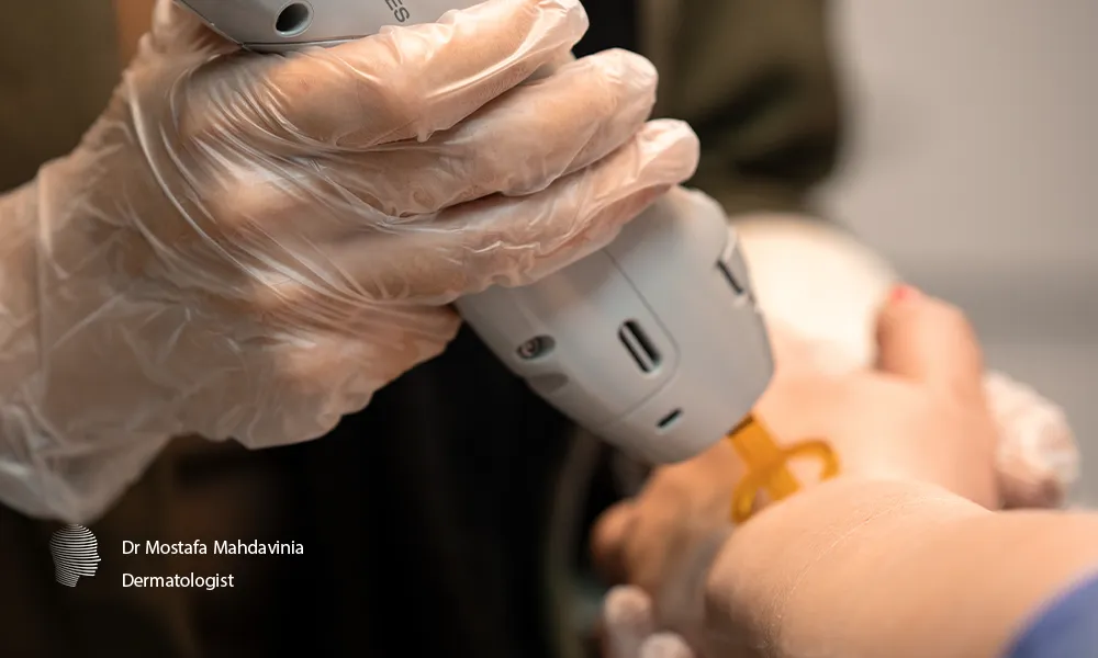 لیزر موهای زائد دست زیباجوی خانم در مرکز تخصصی دکتر مهدوی نیا