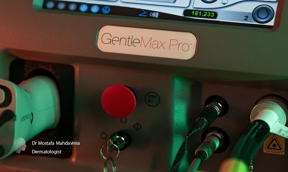 لیزر الکساندرایت کندلا