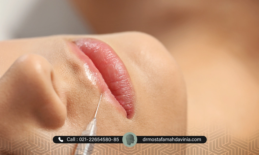 تزریق نیم سی سی ژل به لب بالایی