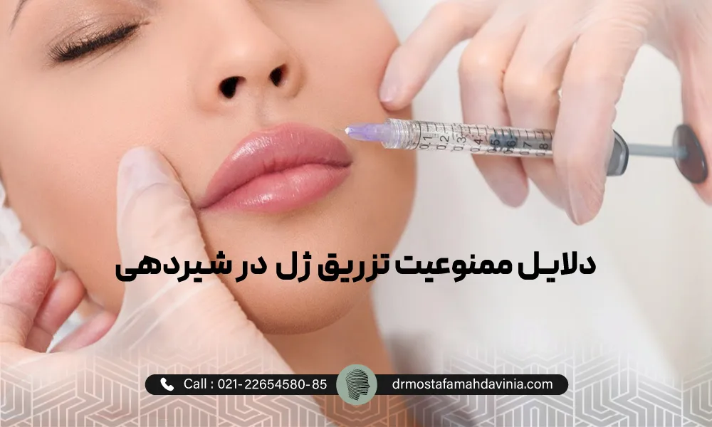 خانمی با چشمان بسته در حال تزریق فیلر به لب بالایی خود | تزریق ژۀ لب در شیردهی