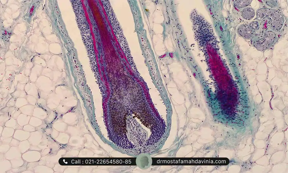 تصویر میکروسکوپی ریشه مو - نحوه عملکرد لیزر موهای زائد 