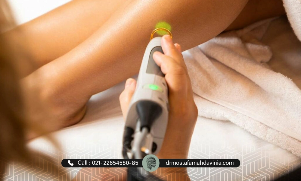 لیزر موهای زائد پای یک خانم | سن مناسب لیزر موهای زائد