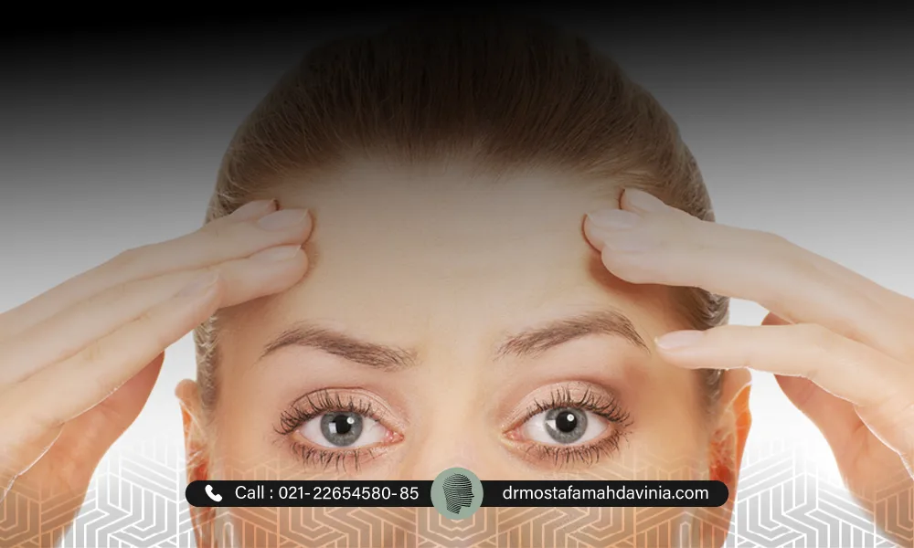 لیفت شقیقه با نخ