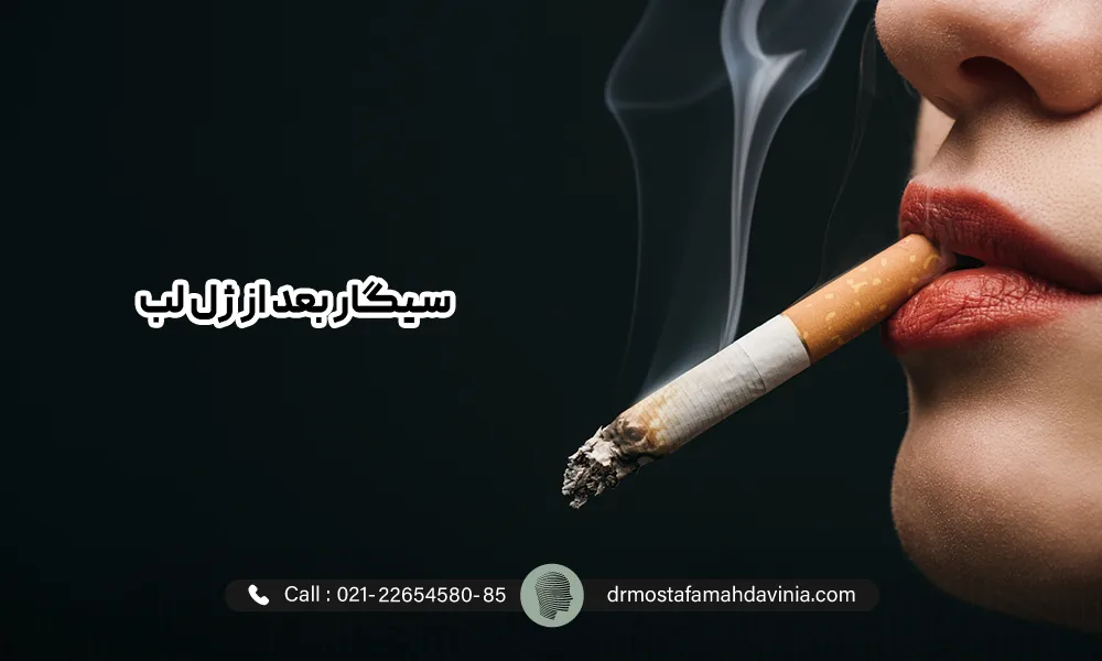 سیگار روی لب های خانمی که تزریق ژل لب انجام داده است.