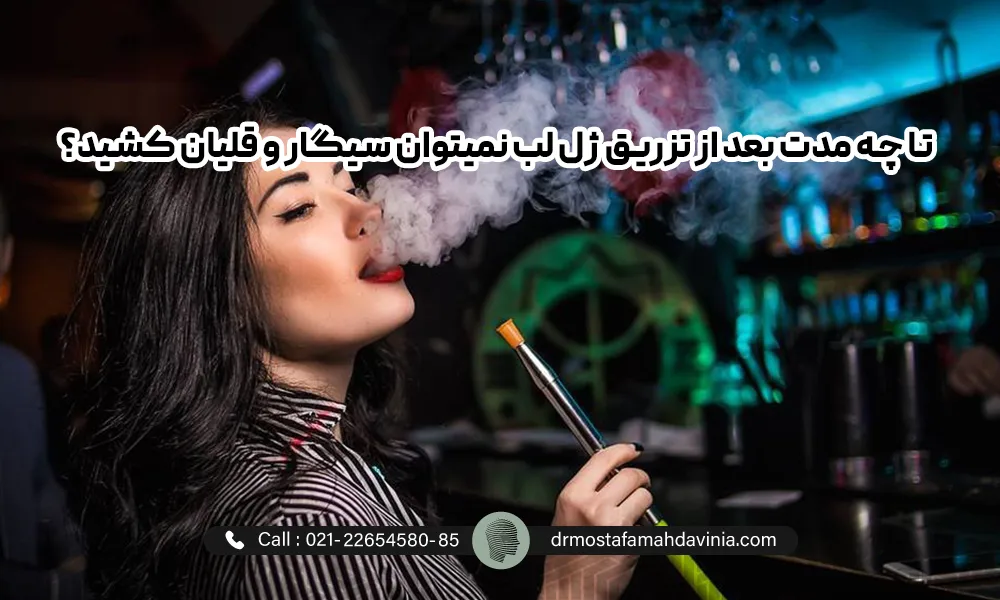 خانمی در حال کشیدن قلیان بعد تزریق ژل لب