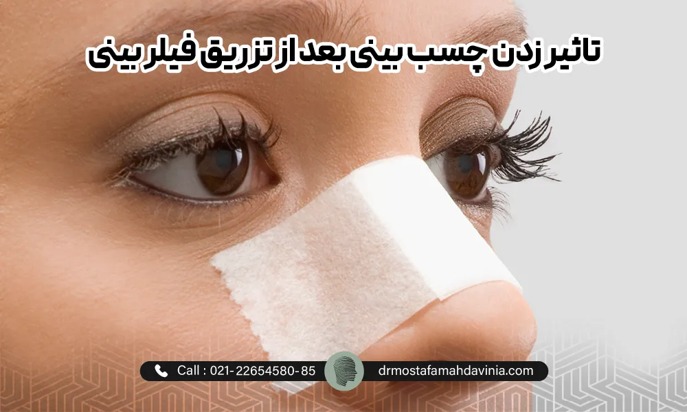 خانمی با چسب بعد از تزریق فیلر بینی