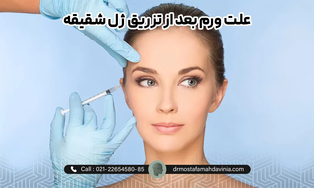 پزشک در حال تزریق فیللر شقیقه برای خانمی با موهای بسته و چشم های رنگی