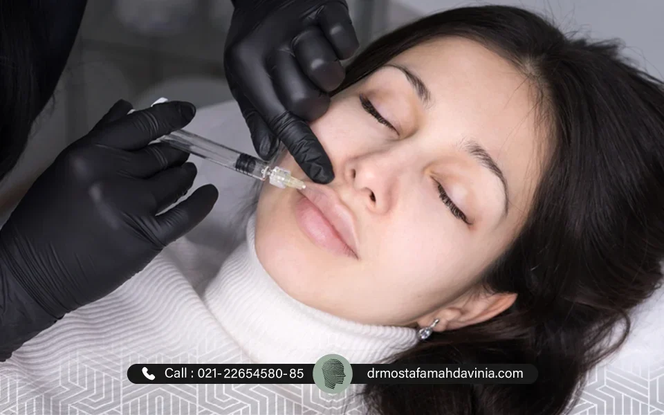 تزریق ژل لب چاک دار برای یک خانم با صورت کشیده