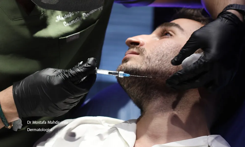 تزریق فیلر برای زاويه سازی فک