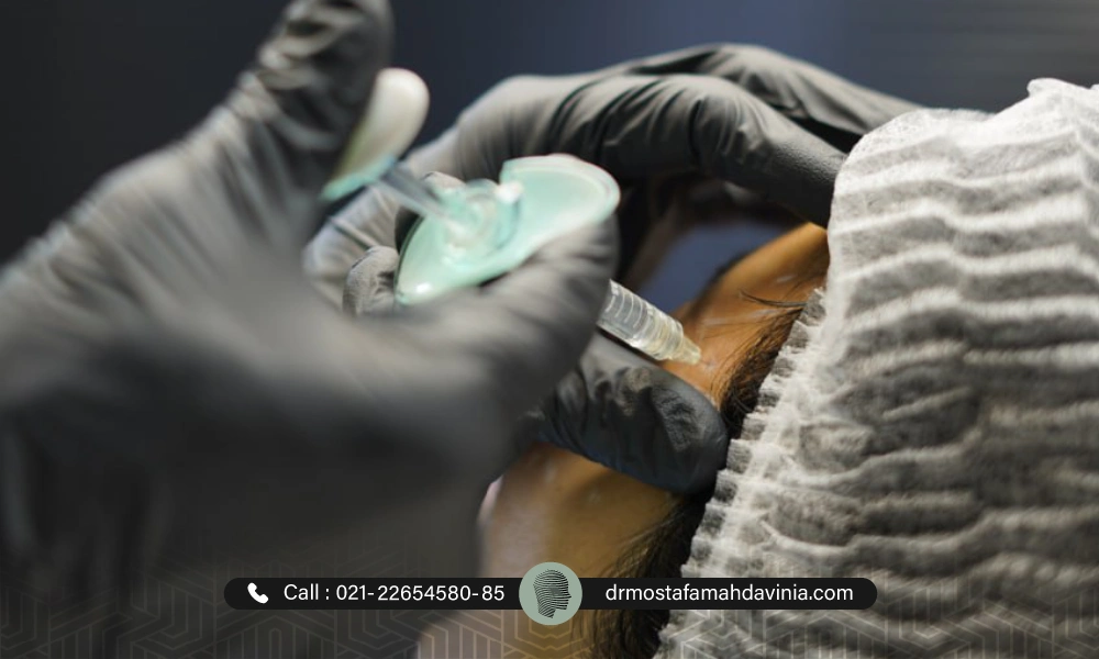 تزریق فیلر شقیقه | دکتر مصطفی مهدوی نیا