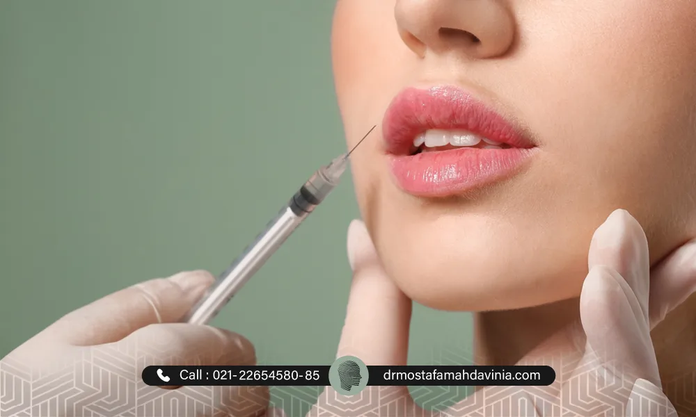 تزریق فیلر به لب های یک خانم زیباجو | تغذیه بعد از تزریق ژل لب