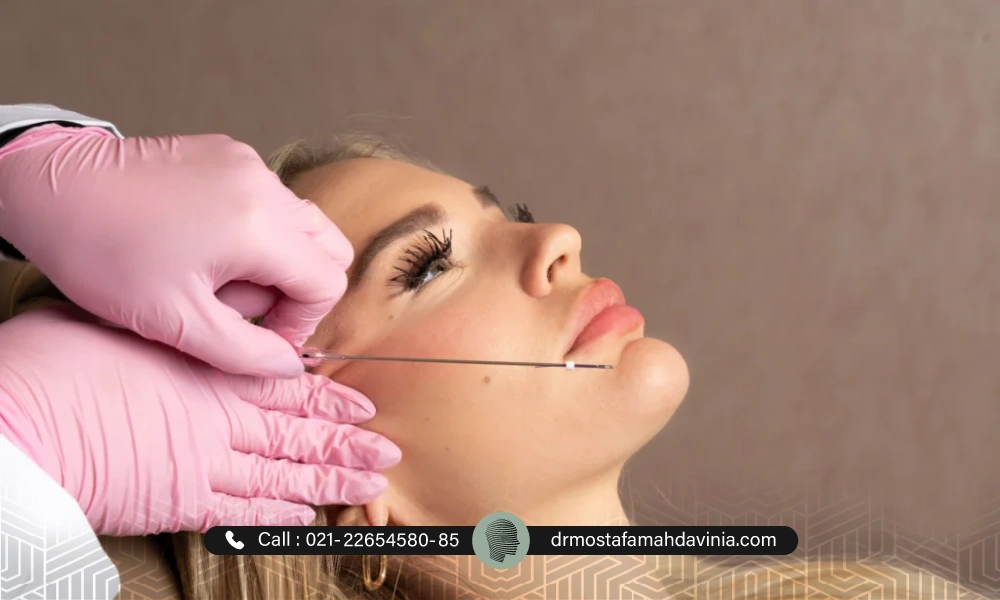 انجام لیفت نخ صورت | پاره شدن نخ لیفت صورت