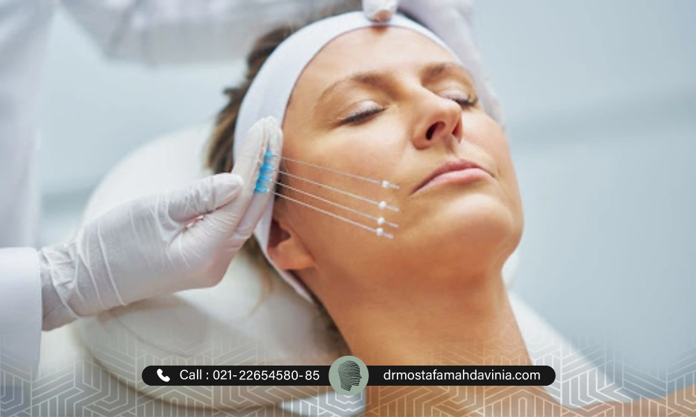 درمان پاره شدن نخ لیفت صورت توسط پزشک