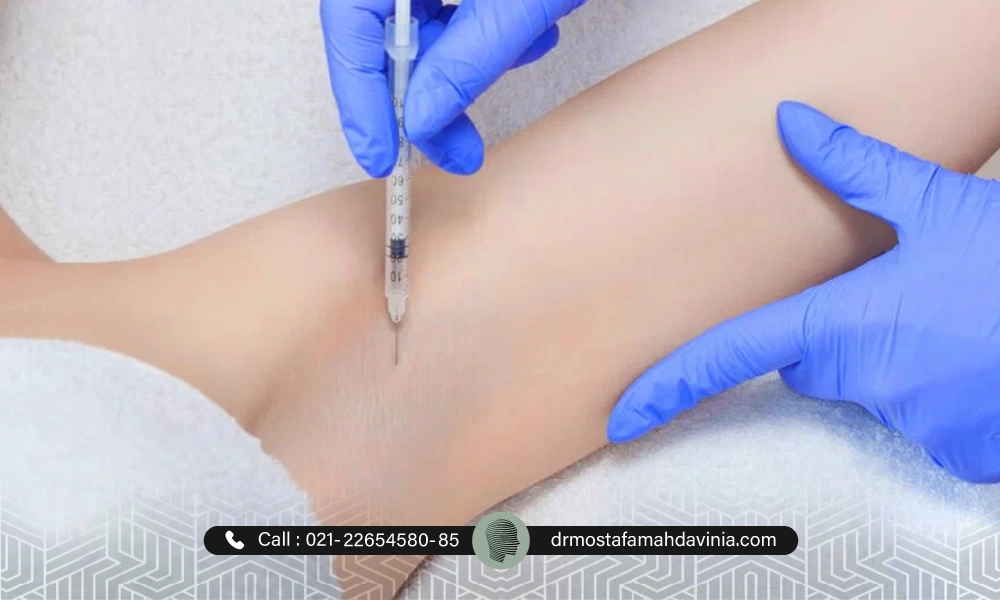 تزریق بوتاکس زیر بغل برای متقاضی برای از بین بردن بوی بد و سفید شدن زیر بغل