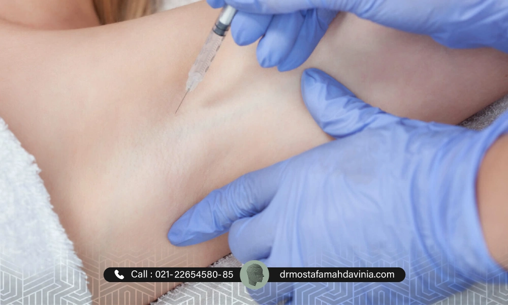 بوتاکس زیر بغل برای یک خانم در حالت خوابیده