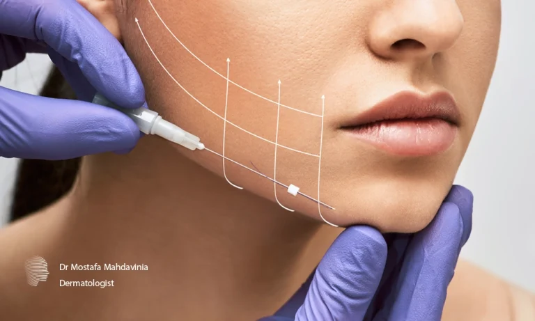 زاویه سازی فک با فیلر