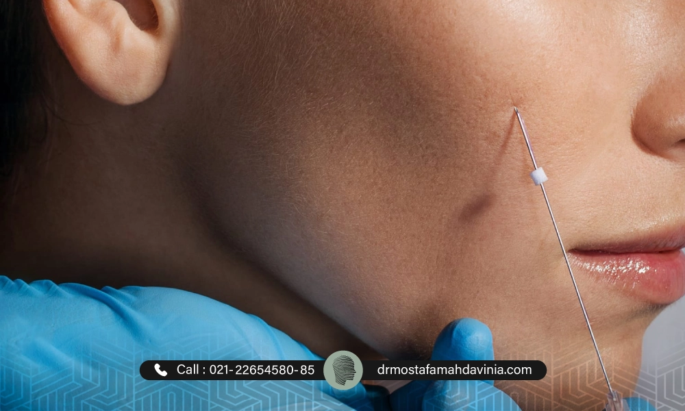 لیفت برای خانم با نخ سگینگ