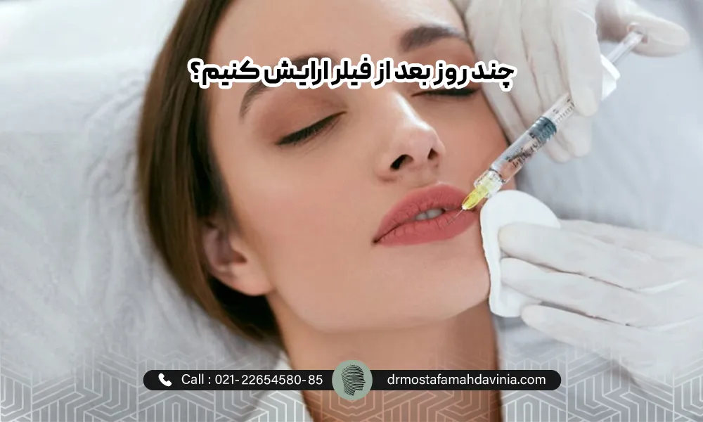 پزشک در حال تزریق فیلر لب برای یک خانمی که چشمان خود را بسته است. | آرایش کردن بعد از تزریق ژل