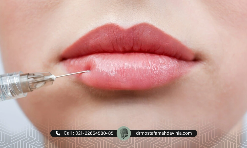 تزریق چند سی سی برای ژل لب روسی