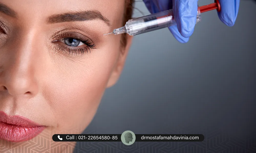 تزریق بوتاکس چشم گربه ای برای یک زیباجو خانم