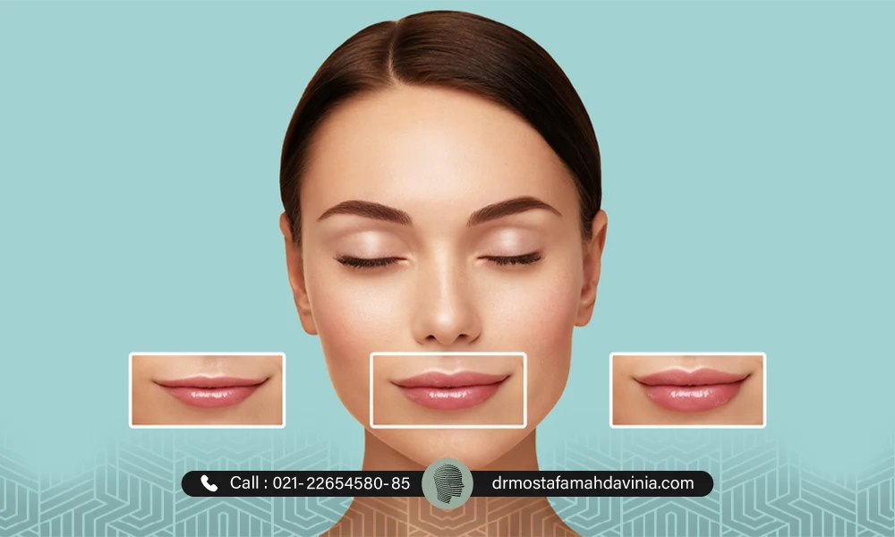 مدل نیم سی سی ژل لب