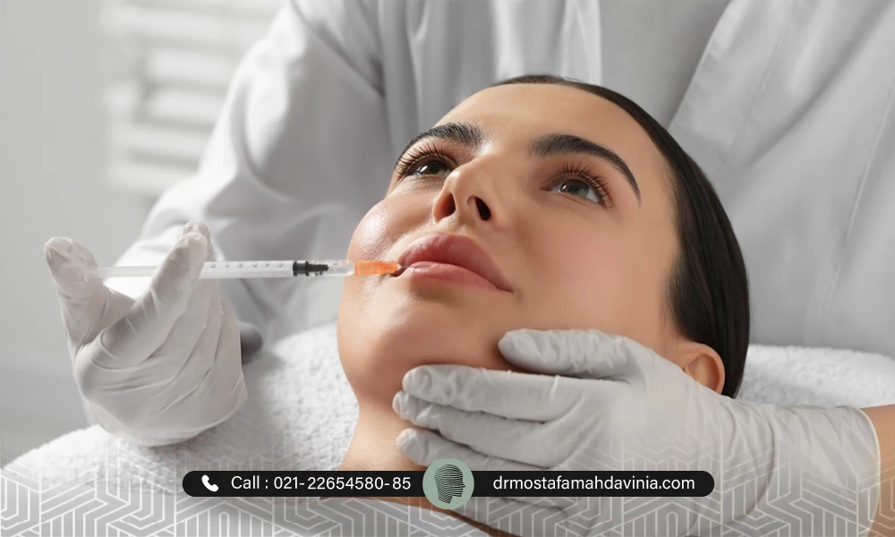 تزریق ژل لب نچرال برای یک خانم زیباجو