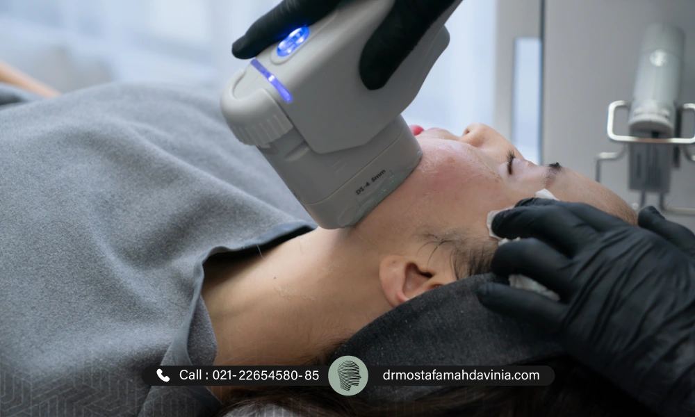 عمل هایفو برای لاغری و از بین بردن چین و چروک صورت | لاغری صورت با هایفو