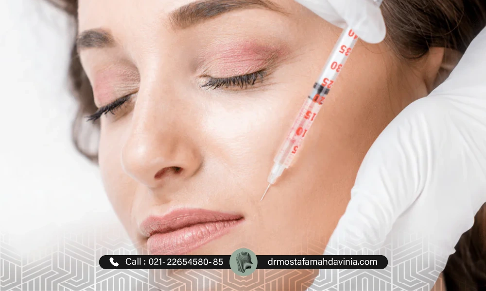 تصویر تزریق ژل خط خنده توسط یک خانم | ورم بعد از تزریق ژل خط خنده