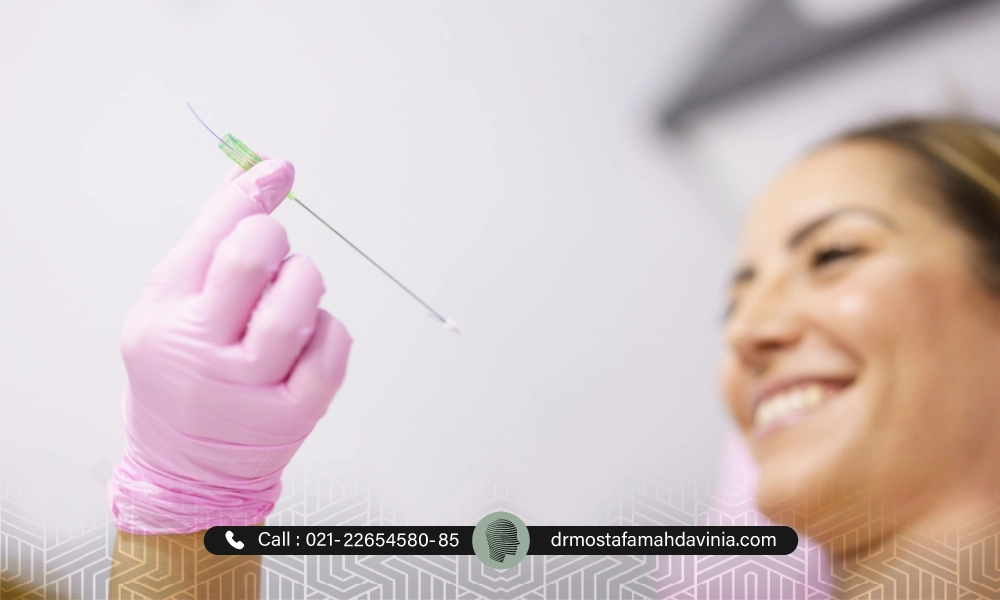 نخ لیفت برای انجام لیفت صورت | مدت زمان جذب نخ لیفت