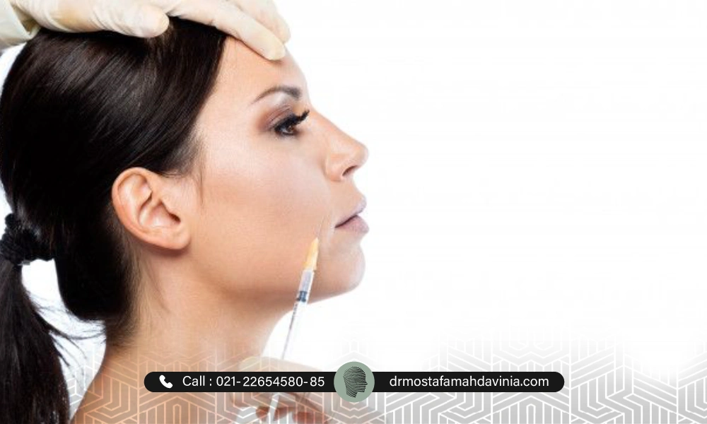 عکس تزریق ژل خط خنده | ورم بعد از تزریق ژل خط خنده